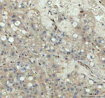 Nova1 Rabbit Polyclonal Antibody