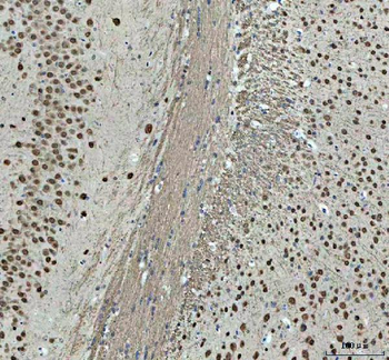 Nova1 Rabbit Polyclonal Antibody