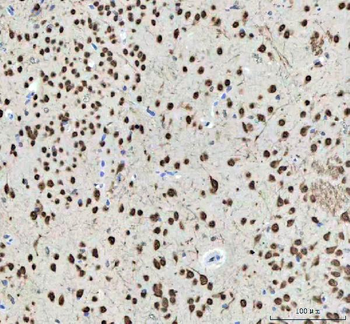 Nova1 Rabbit Polyclonal Antibody