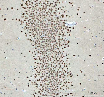 Nova1 Rabbit Polyclonal Antibody