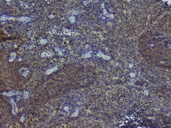 NRF1 Rabbit Polyclonal Antibody