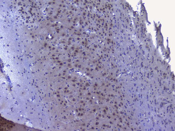 NRF1 Rabbit Polyclonal Antibody