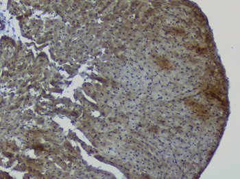 NRF1 Rabbit Polyclonal Antibody