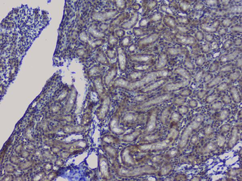 NRF1 Rabbit Polyclonal Antibody