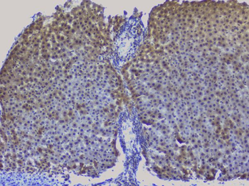 NRF1 Rabbit Polyclonal Antibody