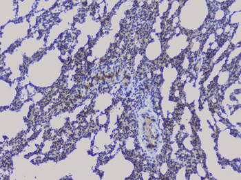 NRF1 Rabbit Polyclonal Antibody