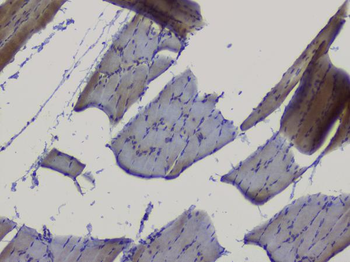 NRF1 Rabbit Polyclonal Antibody