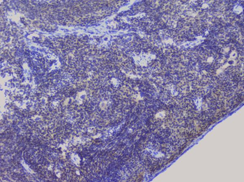 NRF1 Rabbit Polyclonal Antibody