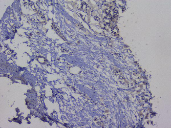 NRF1 Rabbit Polyclonal Antibody