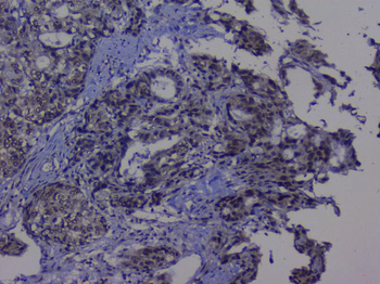 NRF1 Rabbit Polyclonal Antibody