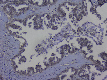 NRF1 Rabbit Polyclonal Antibody