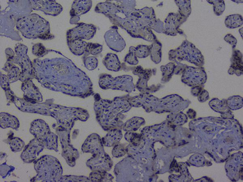NRF1 Rabbit Polyclonal Antibody