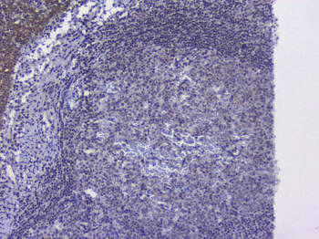 NRF1 Rabbit Polyclonal Antibody