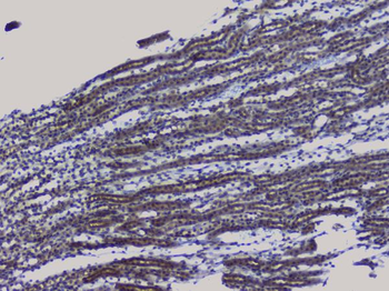 NRF1 Rabbit Polyclonal Antibody