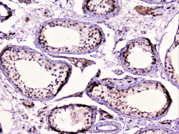 Rad51 Rabbit Polyclonal Antibody