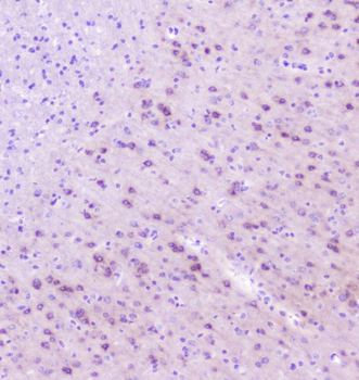 RASAL1/RASAL1 Rabbit Polyclonal Antibody