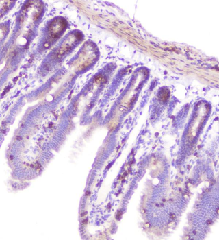 RASAL1/RASAL1 Rabbit Polyclonal Antibody
