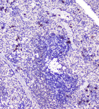 RASAL1/RASAL1 Rabbit Polyclonal Antibody