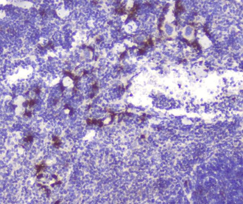 RASAL1/RASAL1 Rabbit Polyclonal Antibody