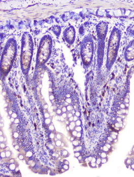 RASAL1/RASAL1 Rabbit Polyclonal Antibody