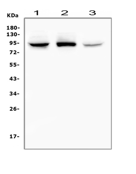 RASAL1/RASAL1 Rabbit Polyclonal Antibody