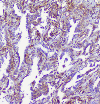 RP2 Rabbit Polyclonal Antibody