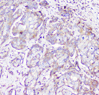 RP2 Rabbit Polyclonal Antibody