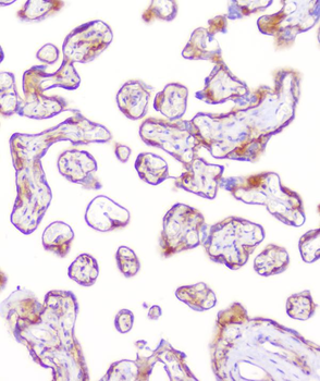 RP2 Rabbit Polyclonal Antibody
