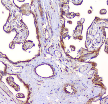 RP2 Rabbit Polyclonal Antibody