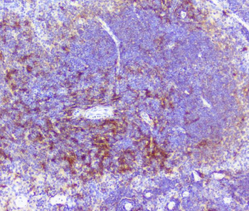 RP2 Rabbit Polyclonal Antibody