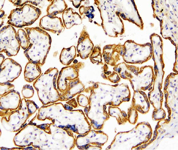 TANK Rabbit Polyclonal Antibody