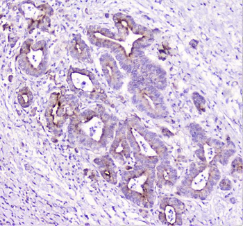 TANK Rabbit Polyclonal Antibody