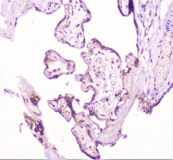 TANK Rabbit Polyclonal Antibody