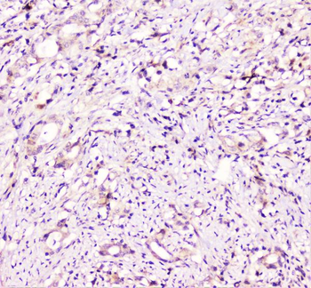 TANK Rabbit Polyclonal Antibody