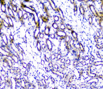 TANK Rabbit Polyclonal Antibody