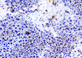 TANK Rabbit Polyclonal Antibody