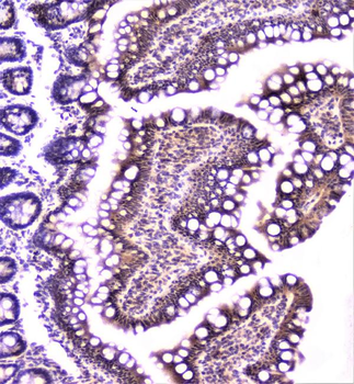 TANK Rabbit Polyclonal Antibody