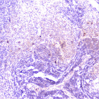 TANK Rabbit Polyclonal Antibody