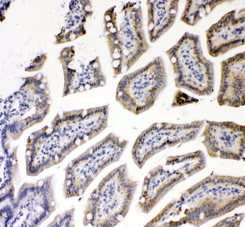 TNF Receptor I/TNFRSF1A Rabbit Polyclonal Antibody
