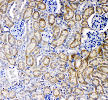 TNF Receptor I/TNFRSF1A Rabbit Polyclonal Antibody
