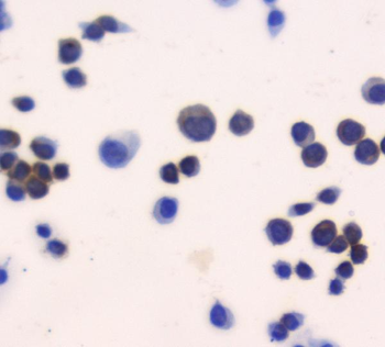 Thioredoxin/TRX/Txn Rabbit Polyclonal Antibody
