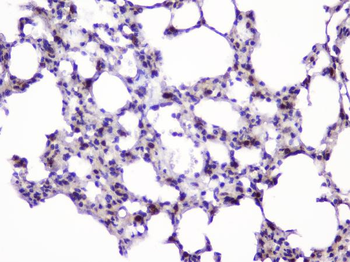 UBE2I UBC9 Rabbit Polyclonal Antibody