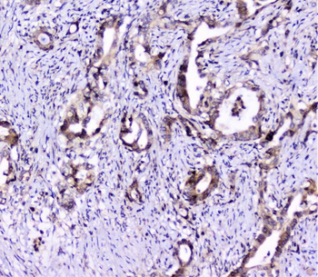 UBE2I UBC9 Rabbit Polyclonal Antibody