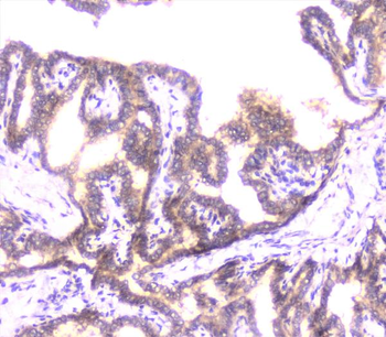UBE2I UBC9 Rabbit Polyclonal Antibody