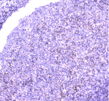 UBE2I UBC9 Rabbit Polyclonal Antibody