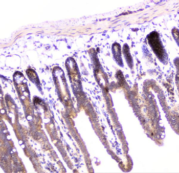 UBE2I UBC9 Rabbit Polyclonal Antibody