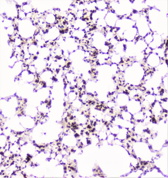 UBE2I UBC9 Rabbit Polyclonal Antibody