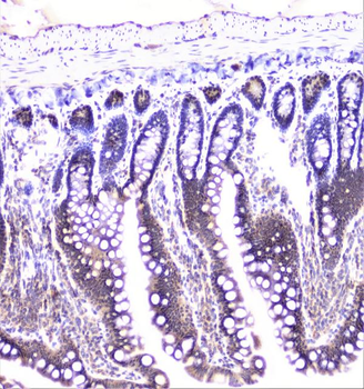 UBE2I UBC9 Rabbit Polyclonal Antibody