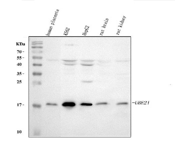 UBE2I UBC9 Rabbit Polyclonal Antibody