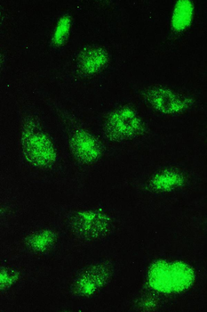 UBE2I UBC9 Rabbit Polyclonal Antibody